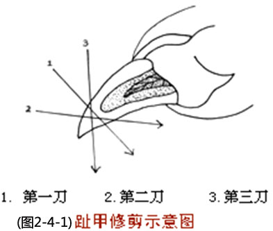 修剪趾甲示意圖