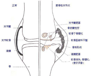 犬骨關節(jié)病