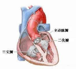 主動(dòng)脈瓣狹窄
