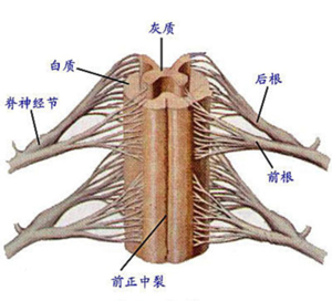 多神經根神經炎